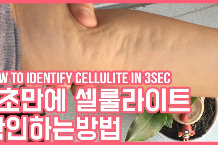 3초만에 내 몸 속 셀룰라이트 확인하는 방법(How To Identify Cellulite In 3Sec) - Youtube