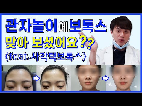 관자놀이에도 보톡스를 맞는다고? 사각턱보톡스와 관자놀이 보톡스는 찰떡궁합! I 잦은 두통이 고민이신 분들에게 추천합니다