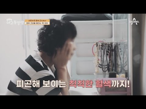 피부 건강을 해치는 적 '광노화'! 자외선이 피부에 미치는 영향은? | 산전수전 여고동창생 77 회