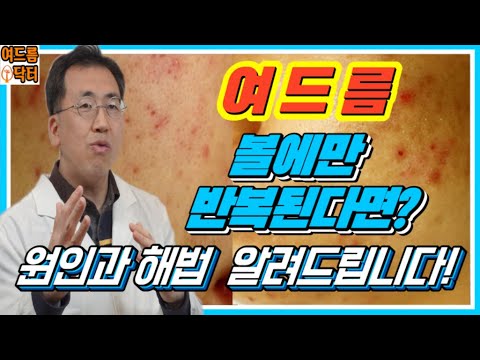 여드름이 볼에 반복해서 올라온다면? 그 원인과 대책 설명드립니다. (여드름닥터)