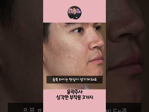 윤곽주사