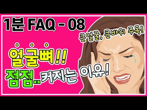 큰얼굴 이유? 얼굴뼈 커지는 이유! 큰얼굴, 큰광대, 사각턱 주목 해주세요~얼굴작아지는법 [교정의 신, 리샘TV]