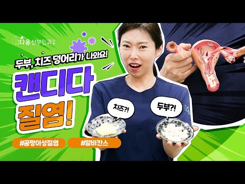 [다움속TV] 두부, 치즈 덩어리가 나와요! 캔디다질염! - 강남다움산부인과