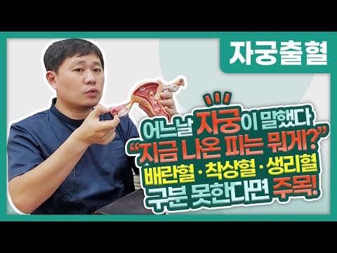 생리기간도 아닌데?! 갑자기 피가?! 질출혈 구분하자