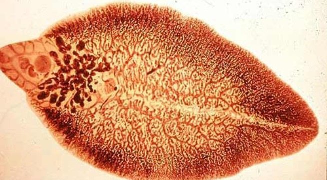 Is Liver Fluke In Humans Dangerous? | Vinmec