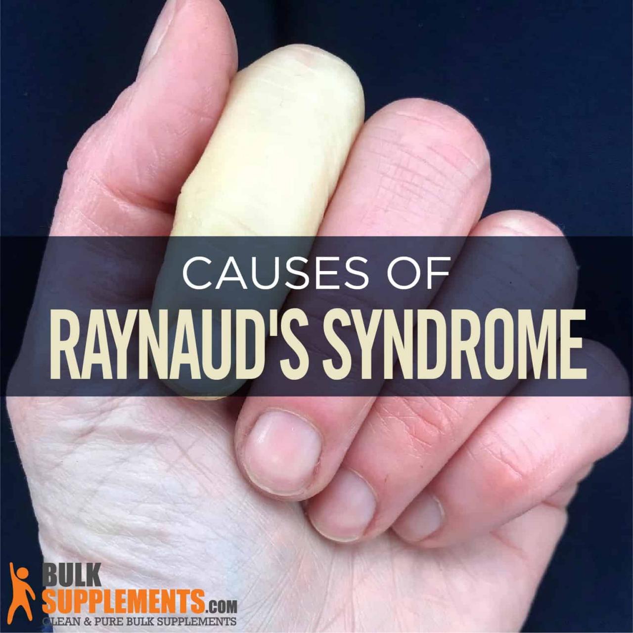 Raynaud'S Syndrome: Symptoms, Causes & Treatment