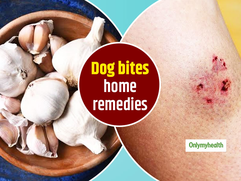 How To Treat A Dog Bite Naturally? Check Out These 7 Home Remedies |  Onlymyhealth