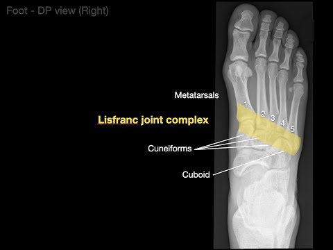 Anatomy of Foot X-rays