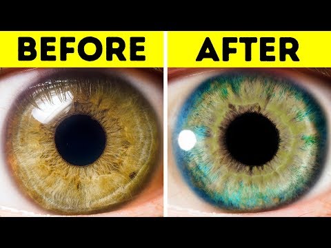 7 Things That Can Change Your Eye Color