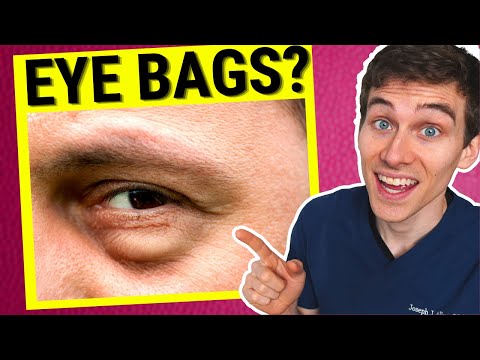 Eye Doctor Explains How to Get Rid of Under EYE BAGS