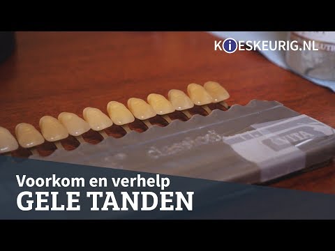 Gele tanden? Dit doe je eraan!