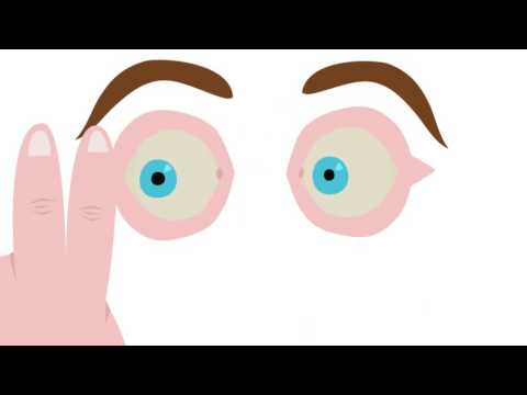 How EMDR works? Look at this animation (English)