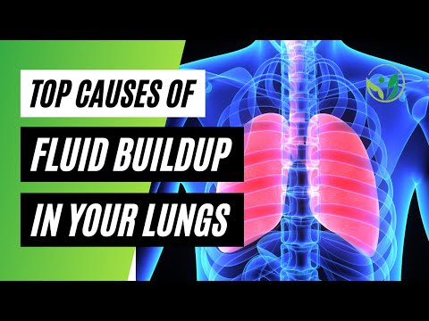 Causes of Fluid Buildup In Your Lungs: Pulmonary Edema Causes & Symptoms